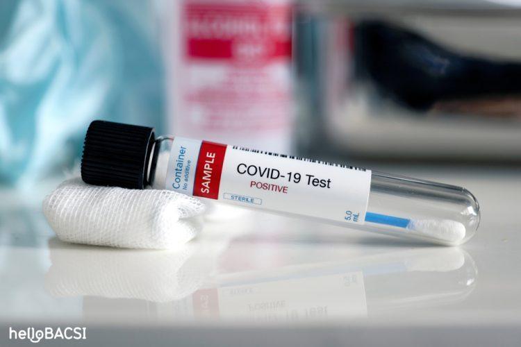 người nhiễm covid-19 khỏi bệnh dương tính trở lại