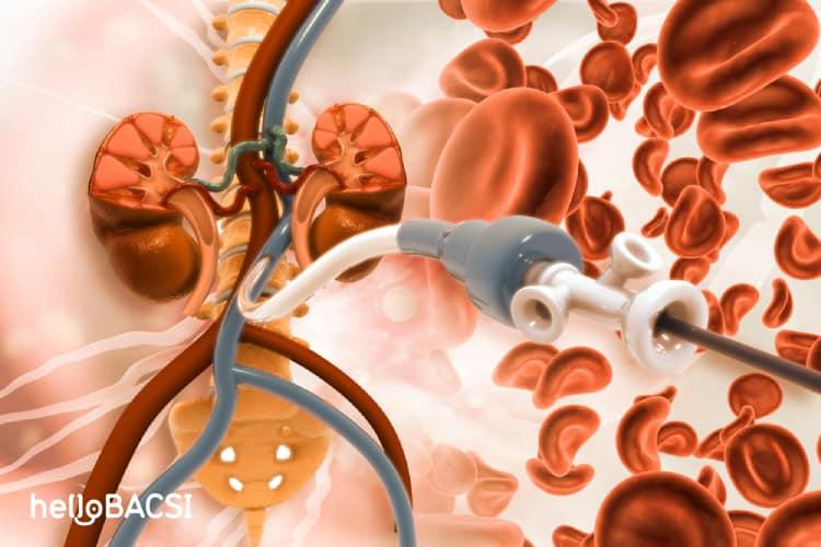 Động mạch ngoại biên (PAD)