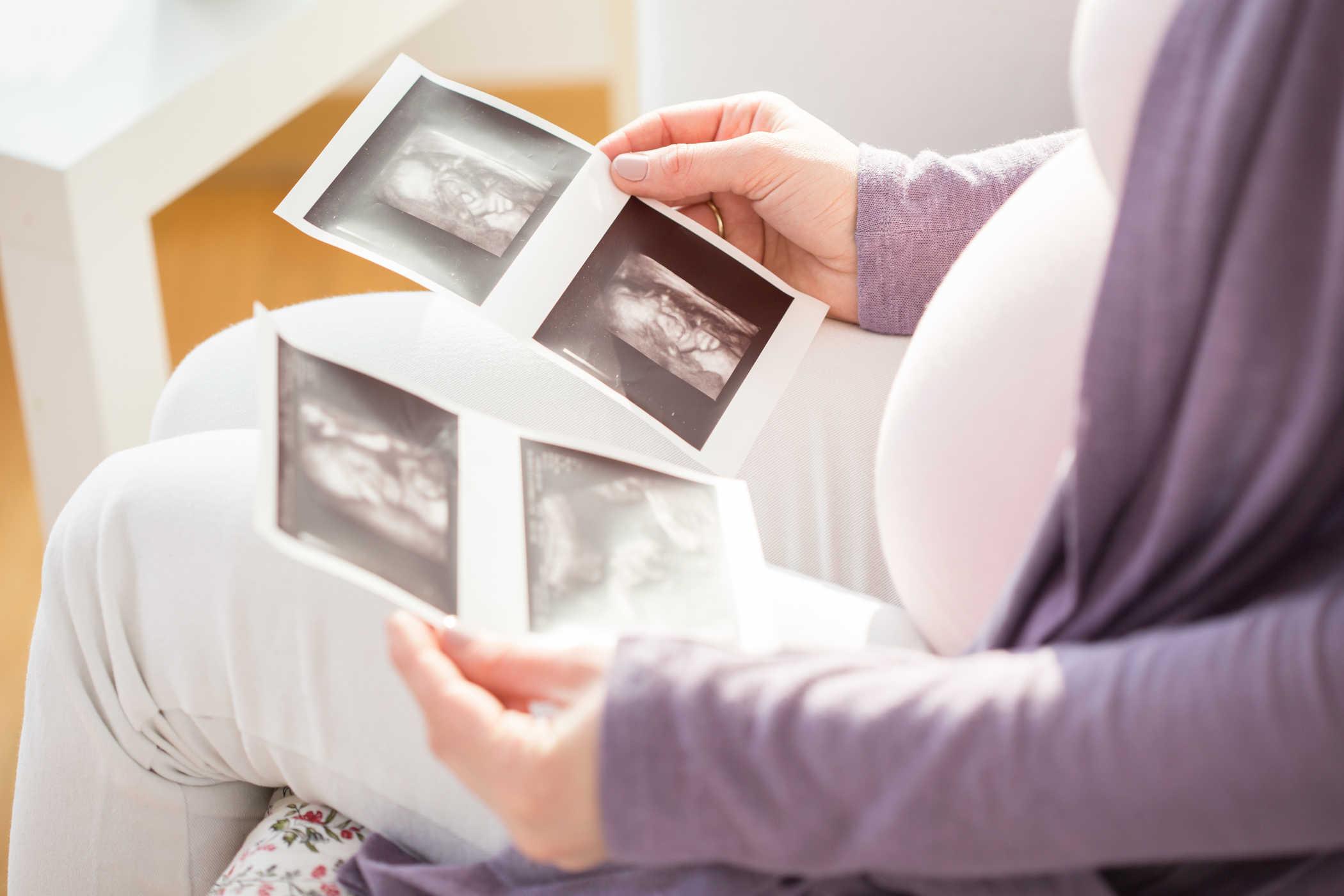 Làm sao để biết thai nhi là bé trai hay gái?