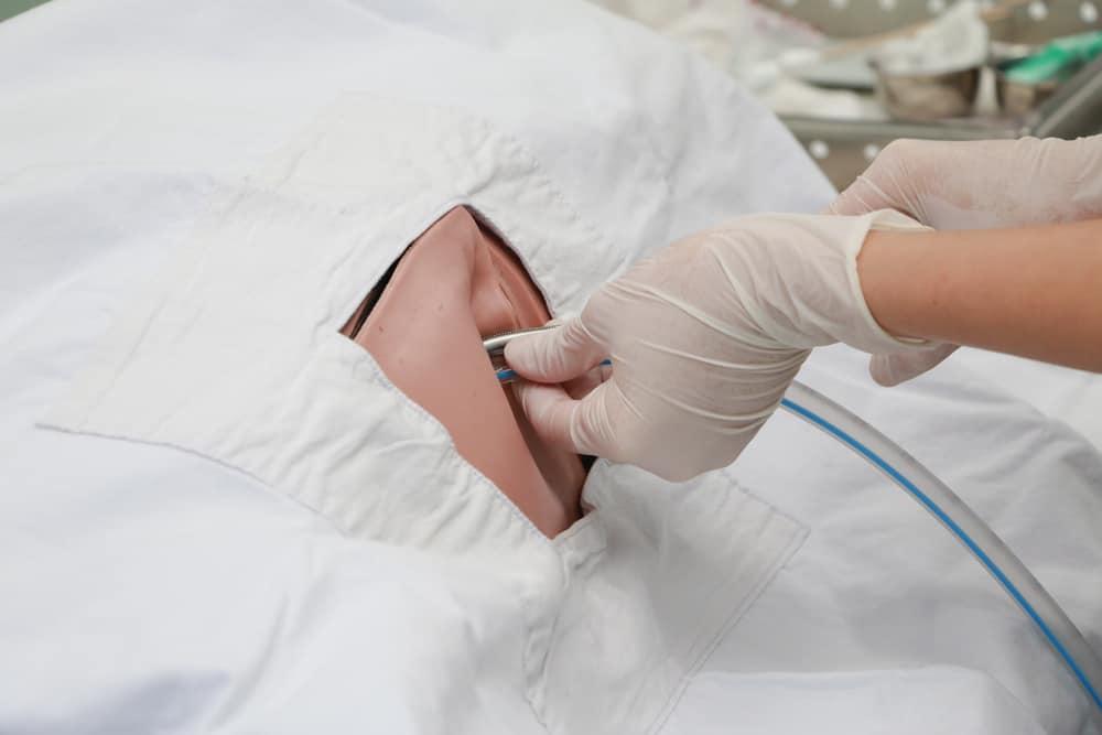 Đặt ống dẫn lưu màng phổi