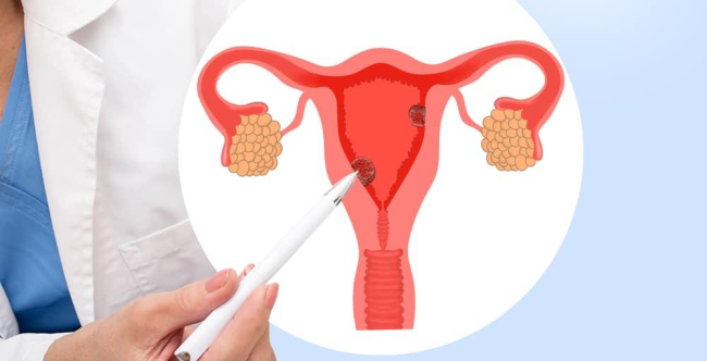Nội soi tử cung có đau không? Chi phí thế nào và quy trình thực hiện ra sao?