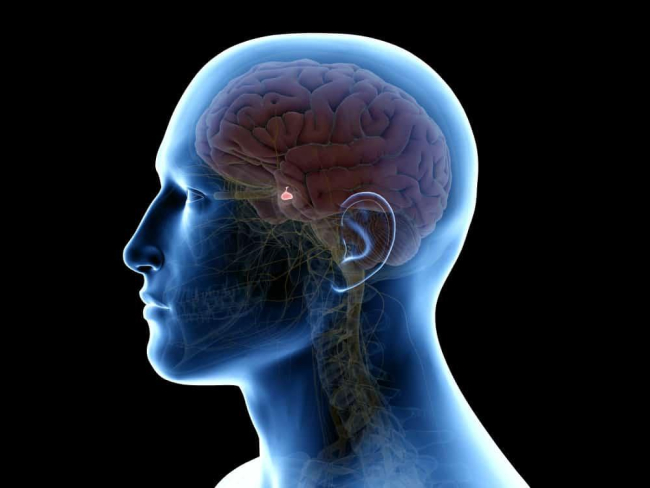 Suy tuyến yên (giảm hormone tuyến yên)