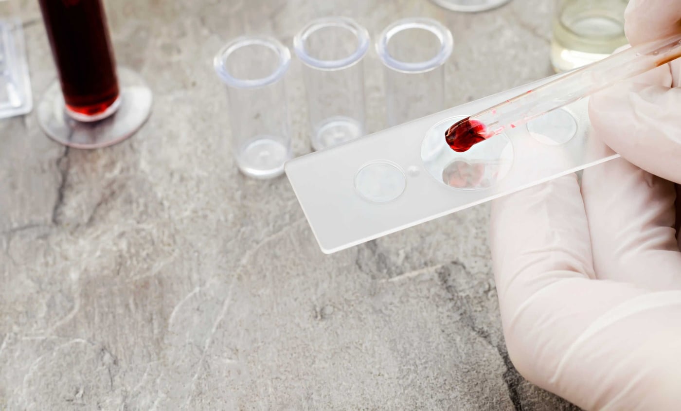 Bệnh mạch máu não có thể gây ra đột quỵ