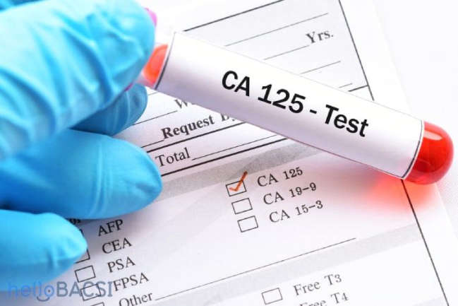 Xét nghiệm CA-125 chẩn đoán bệnh ung thư buồng trứng