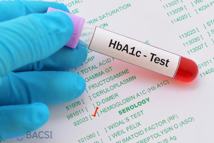 Xét nghiệm HbA1c