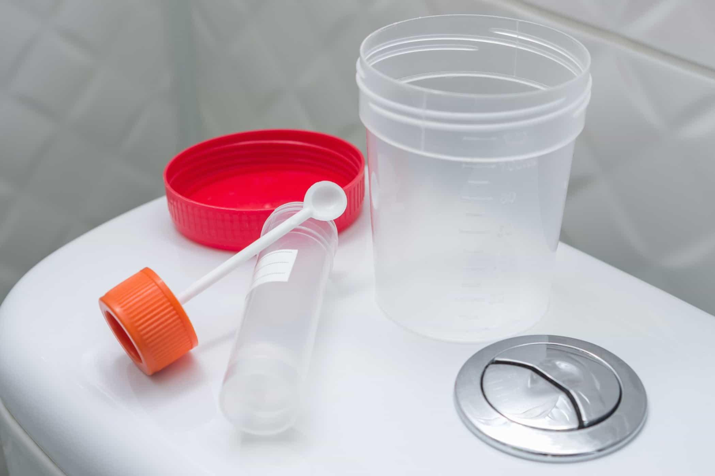 Xét nghiệm phân là gì? Quy trình thực hiện, cách đọc kết quả ra sao?