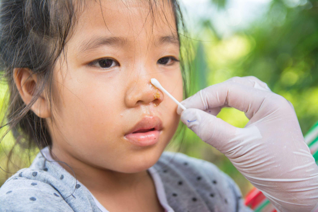 Xử lý thế nào khi mũi bị đau?