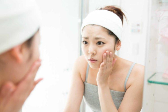 Chăm sóc da mụn: Để mụn không còn là nỗi lo