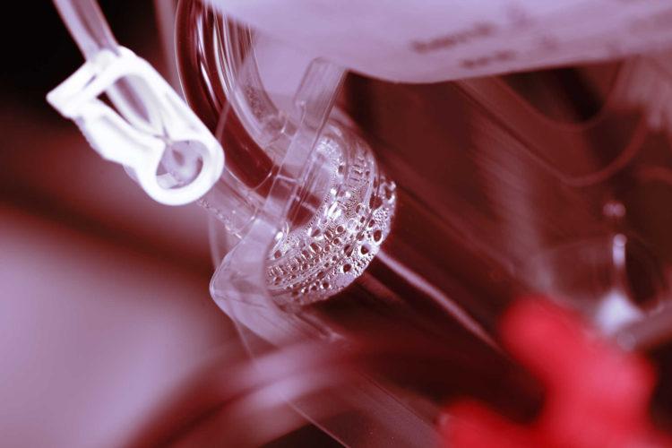 Thiếu máu do mắc các bệnh viêm nhiễm mãn tính