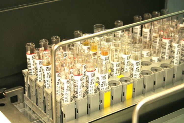 Xét nghiệm nào phát hiện bệnh thiếu máu?