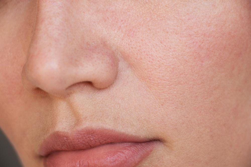 Cách làm se khít lỗ chân lông hiệu quả bằng phương pháp và kỹ thuật hiện đại