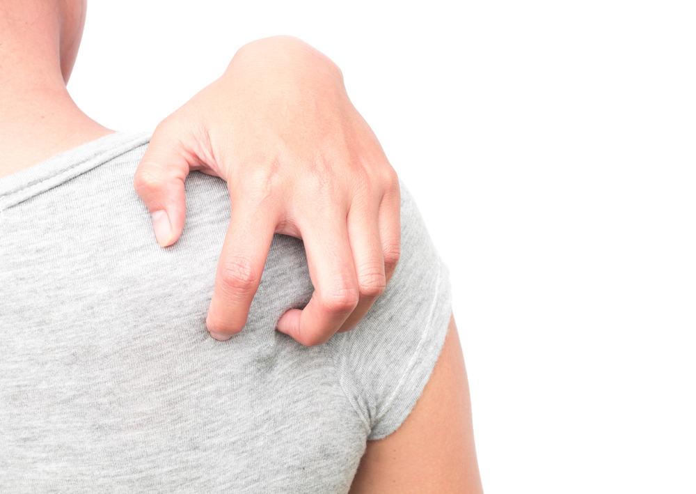 Bệnh lác đồng tiền (hắc lào) và những điều cần biết