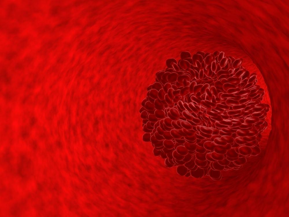 Nhiễm amip entamoeba histolytica đường ruột