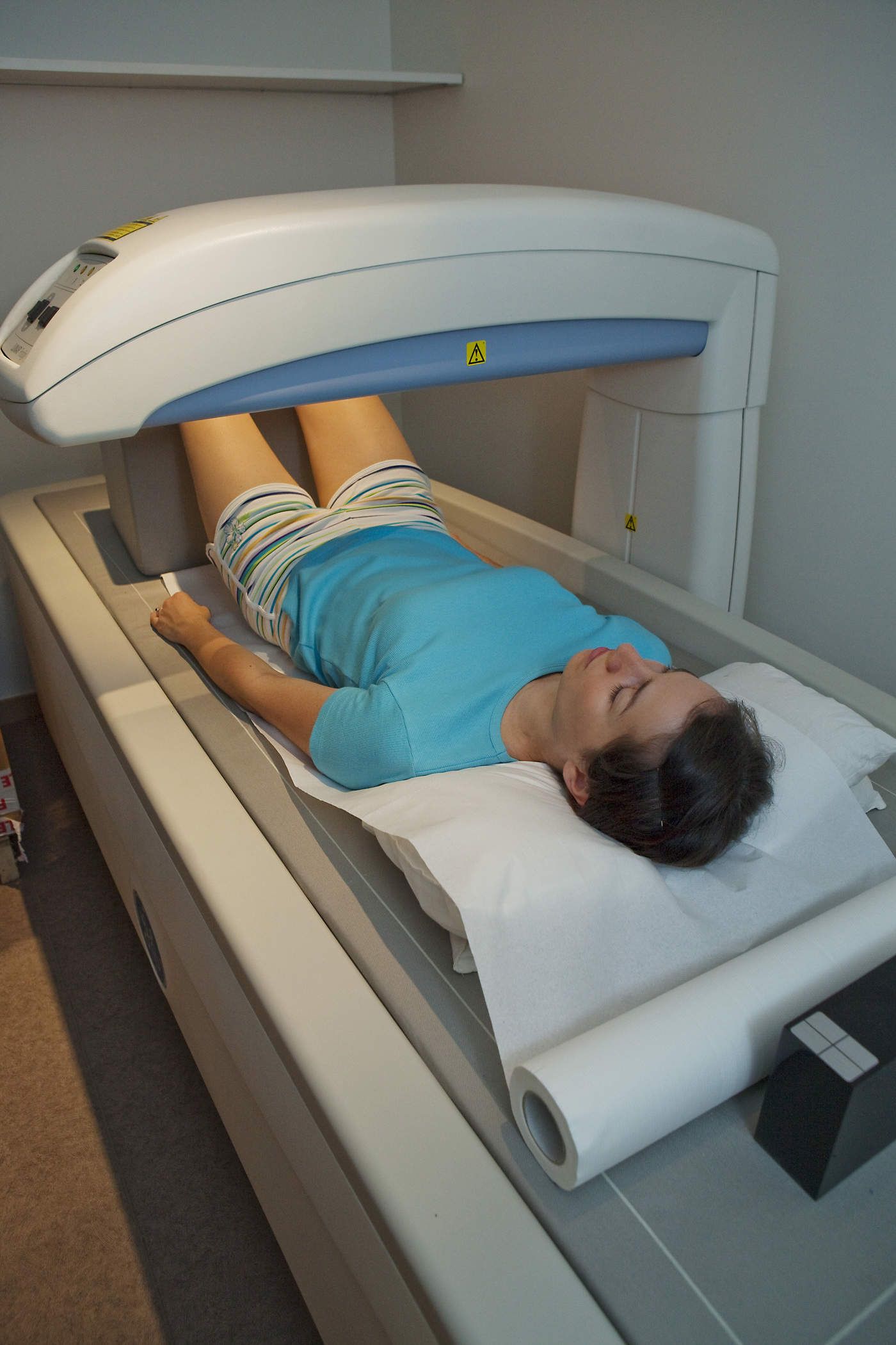 Những điều cần biết về xét nghiệm đo mật độ xương