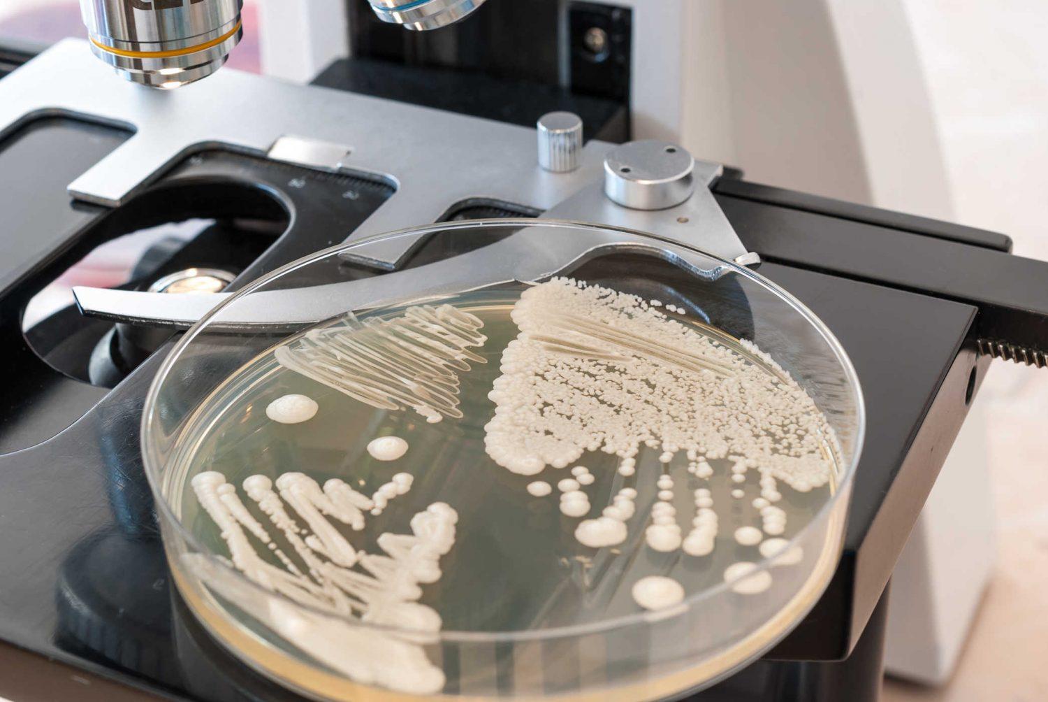 Bệnh nấm candida không phải là bất trị