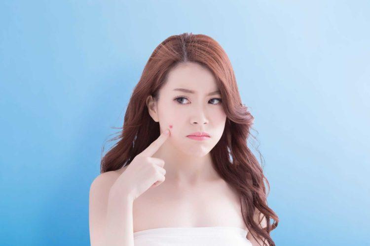 Ung thư tế bào hắc tố hay nám da, phân biệt thế nào?