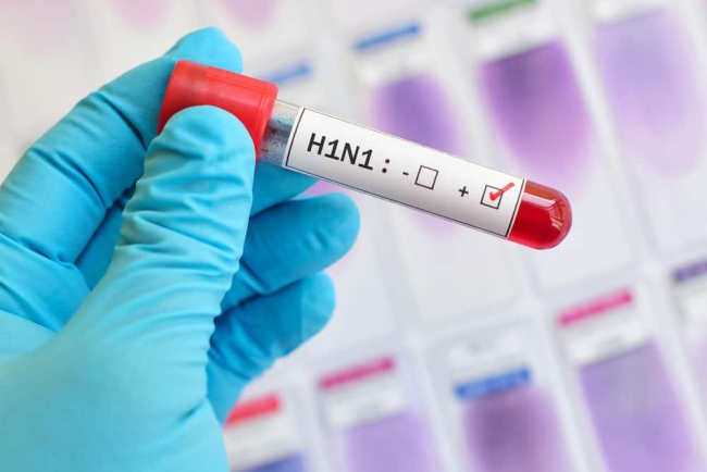 Cúm A (H1N1)