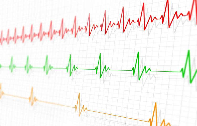 Nhịp tim chậm có sao không, nguy hiểm không và cách điều trị