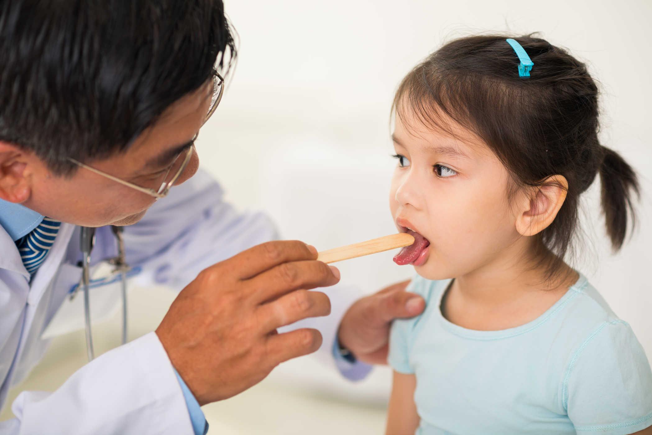 Điều trị đau họng cho trẻ từ A-Z mà bố mẹ nên biết