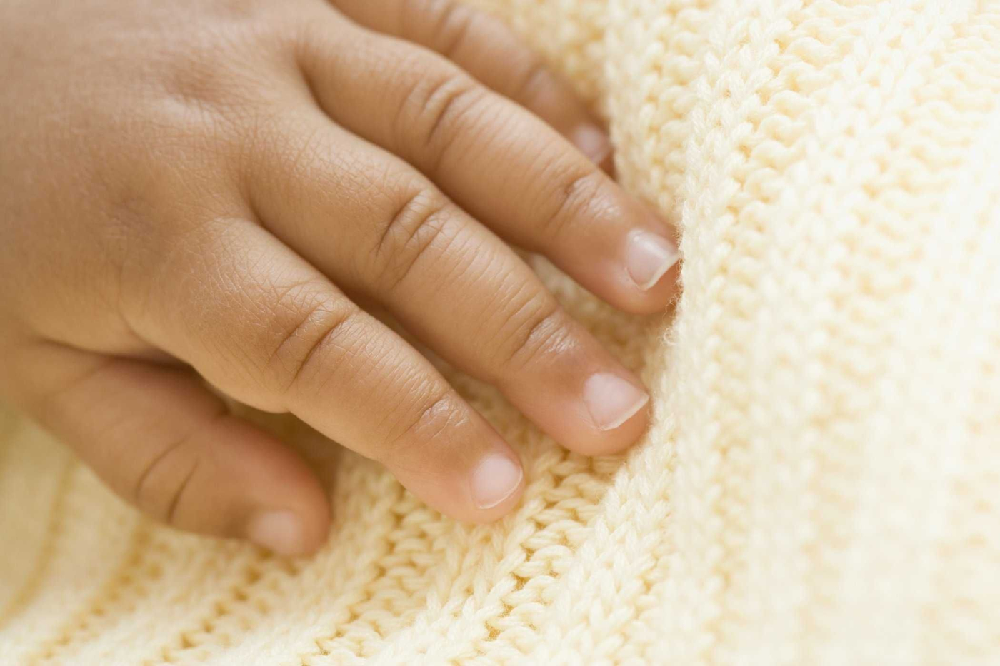 Những bệnh về móng thường gặp ở trẻ