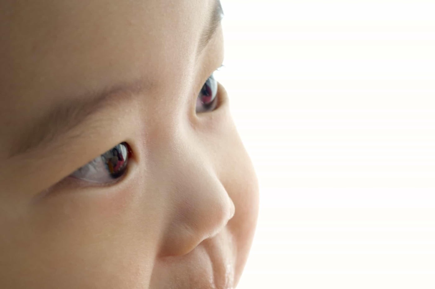 Bệnh võng mạc ở trẻ sinh non