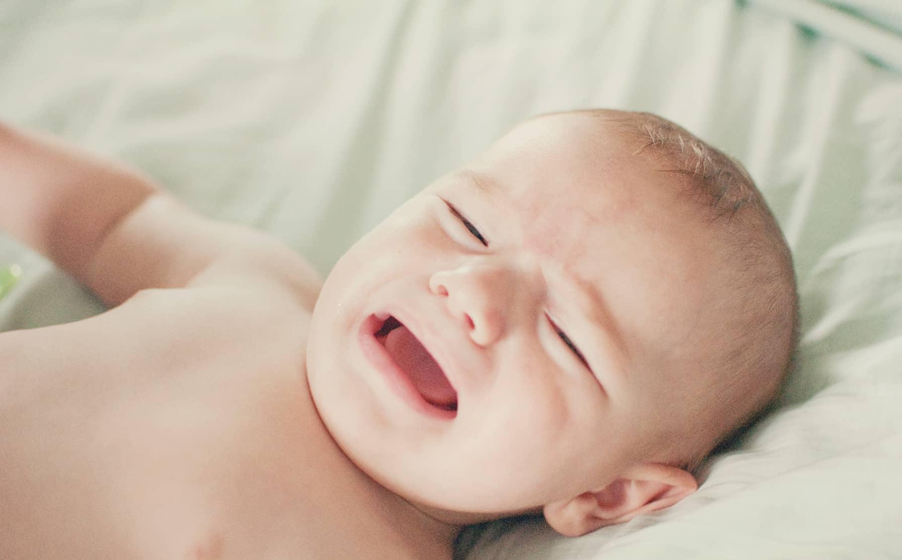 Hẹp đường mật bẩm sinh