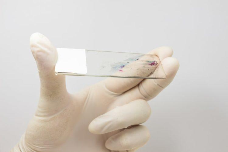 Xét nghiệm phết tế bào cổ tử cung khi mang thai có an toàn không?