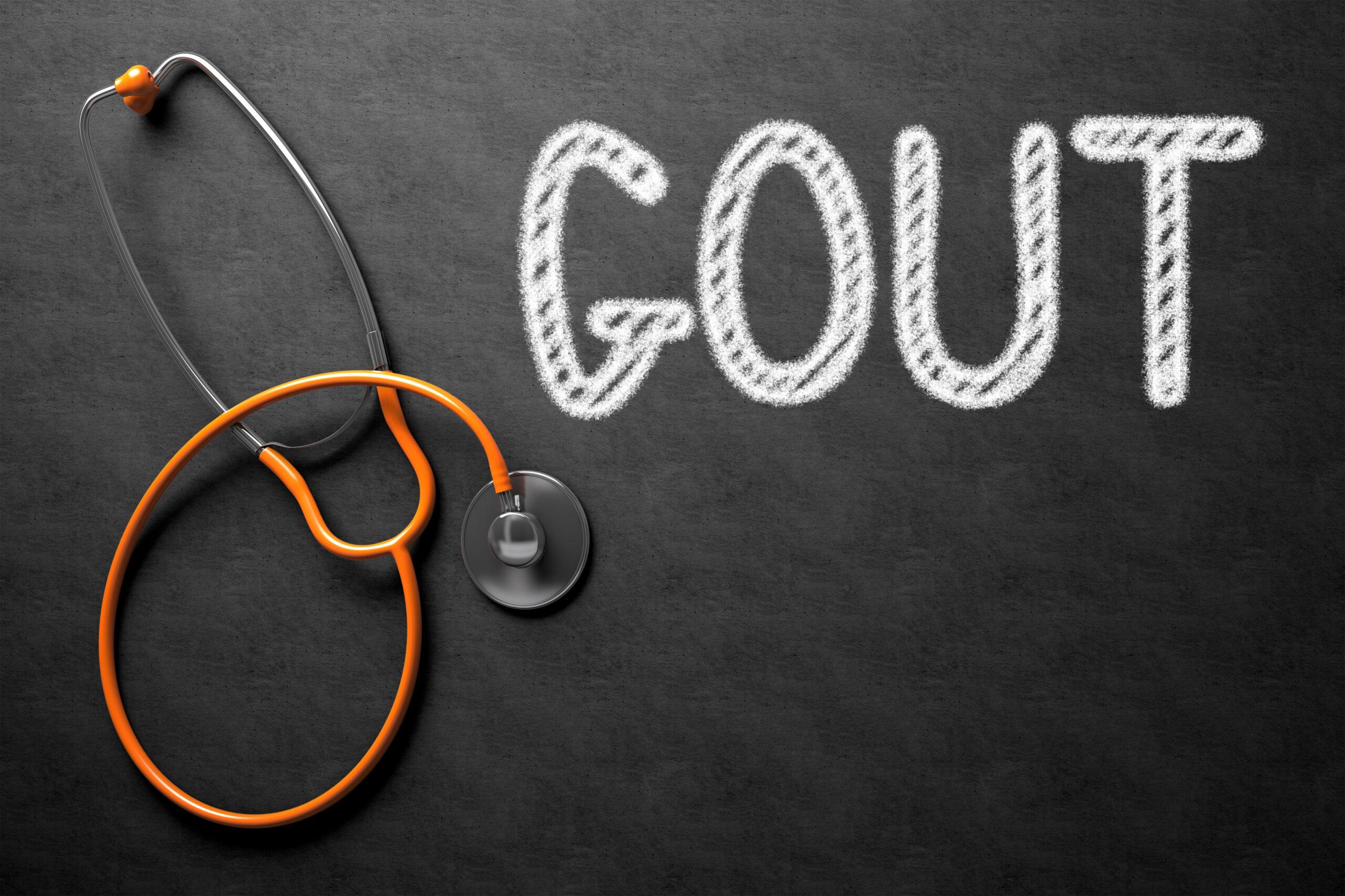 Giúp bạn điều trị bệnh gout (gút) tại nhà