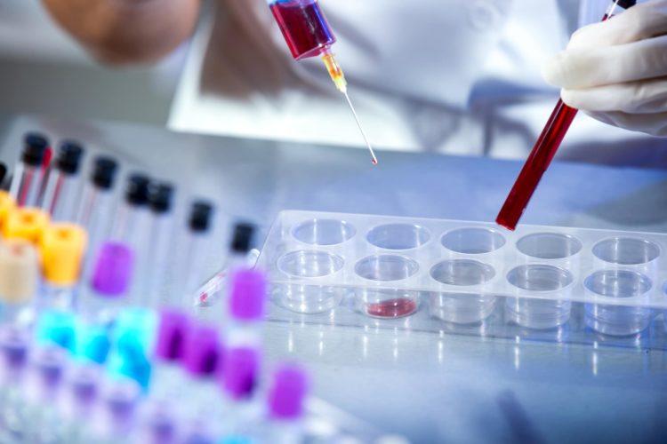 Xét nghiệm glucose sau ăn