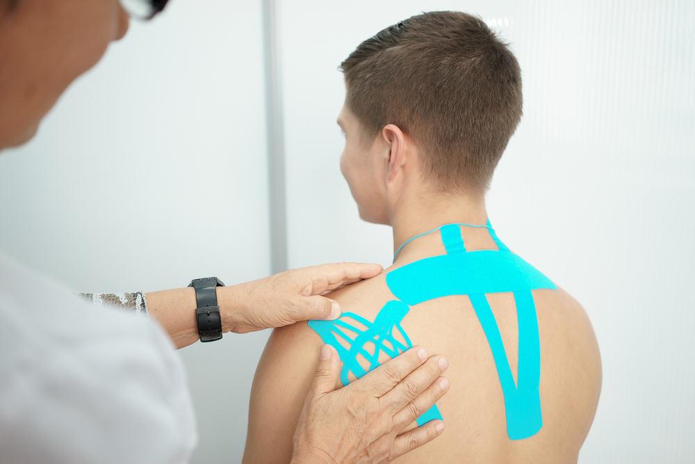 Băng dán cơ Kinesio là gì?