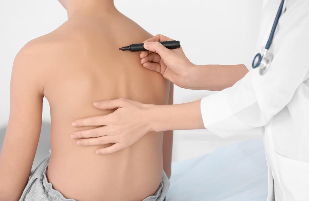 Những phương pháp chữa vẹo cột sống không phẫu thuật