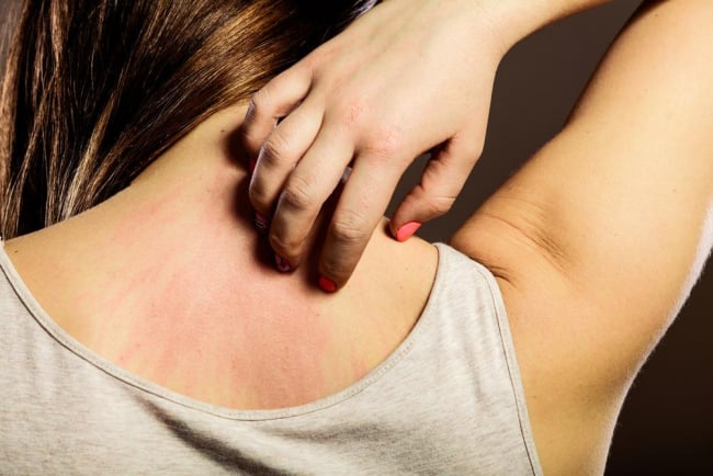 Da kích ứng: Nguyên nhân và cách chữa trị