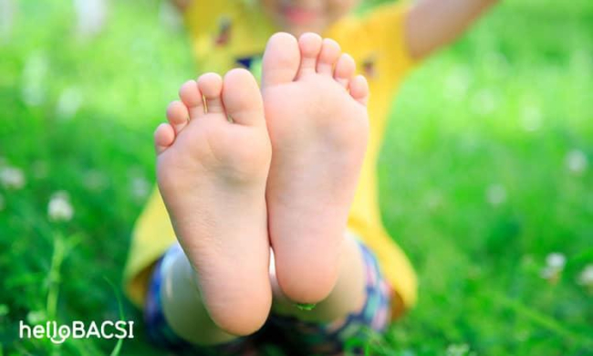 Nguyên nhân bị bàn chân bẹt và cách ngăn ngừa hiệu quả