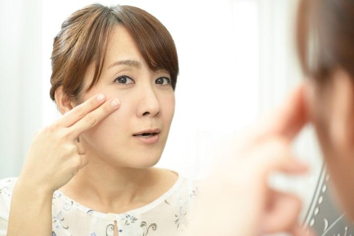 Nếp nhăn: Nguyên nhân hình thành và Cách phòng ngừa