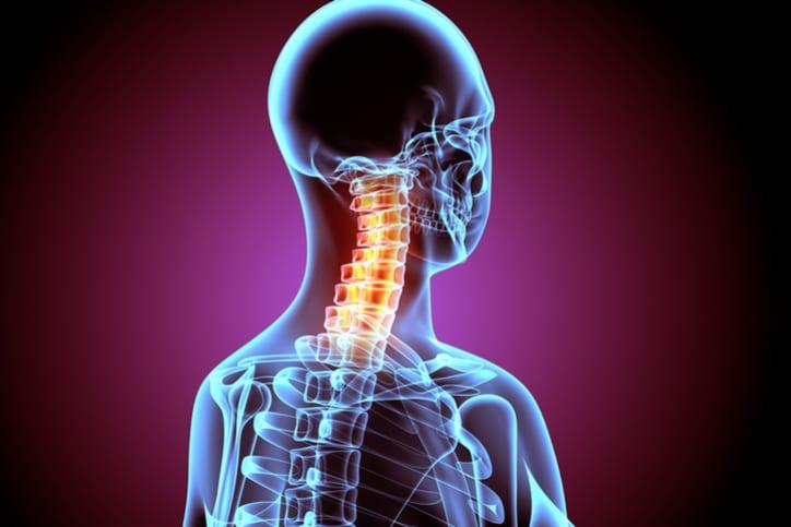 Các cách điều trị bệnh loãng xương hiệu quả cho người lớn tuổi