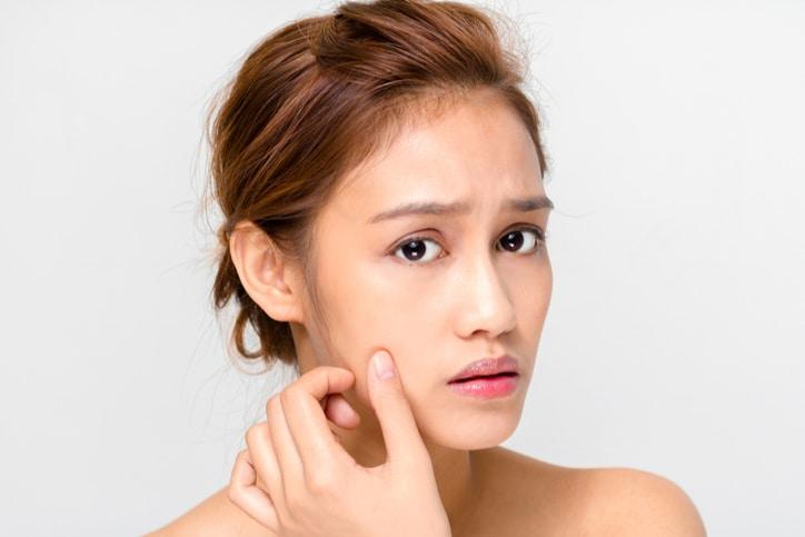 Phân loại sẹo và cách trị sẹo mà bạn nên biết