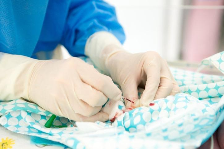 Tràn máu màng phổi: Nguyên nhân, cách điều trị và tiên lượng bệnh