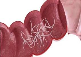 Ivermectin là thuốc gì? Tác dụng, liều dùng, cách dùng