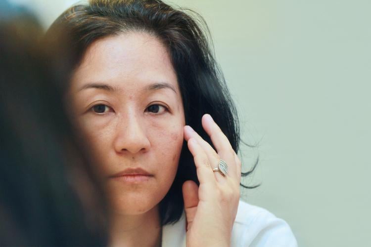 Phương pháp trị sẹo trên mặt hiệu quả