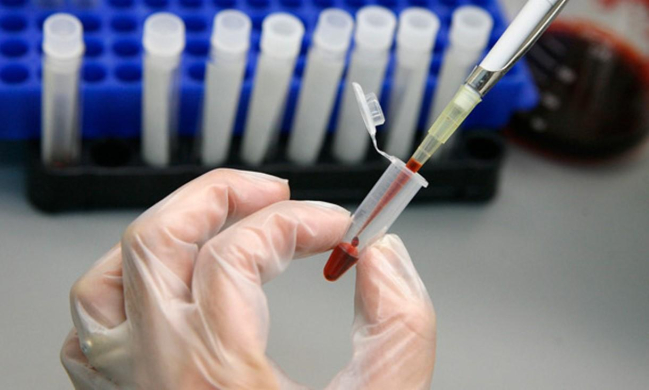 10 sự thật về HIV không phải ai cũng biết: Tìm hiểu ngay để tự phòng tránh