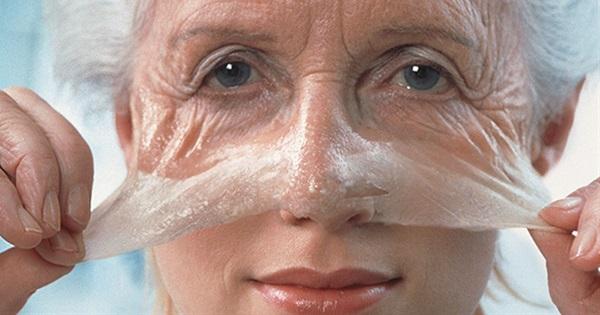 Superoxide Dismutase