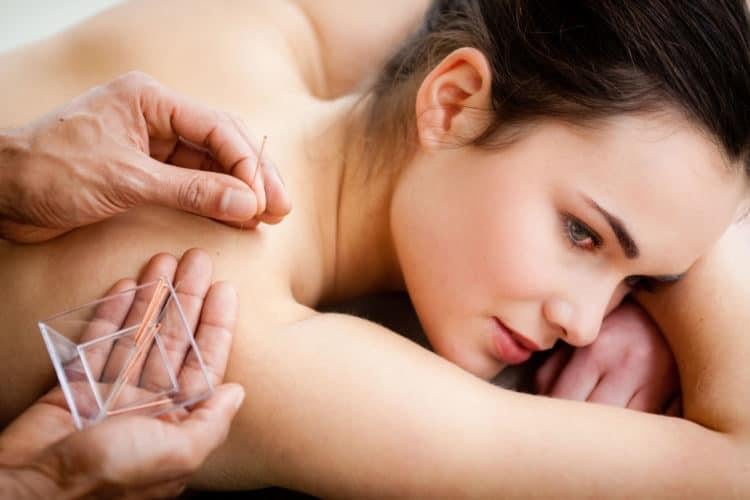 Châm cứu giúp chống dị ứng