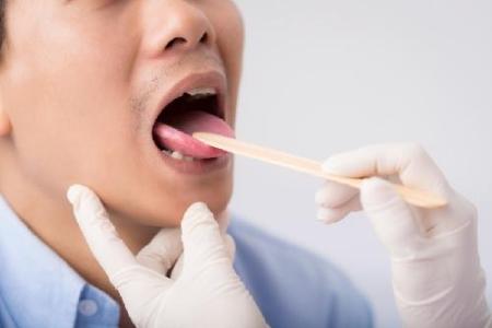 Giải đáp thắc mắc: Lưỡi bị nứt là bệnh gì, có cần điều trị hay không?