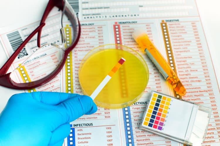 Điều trị nhiễm trùng đường tiết niệu khi mang thai