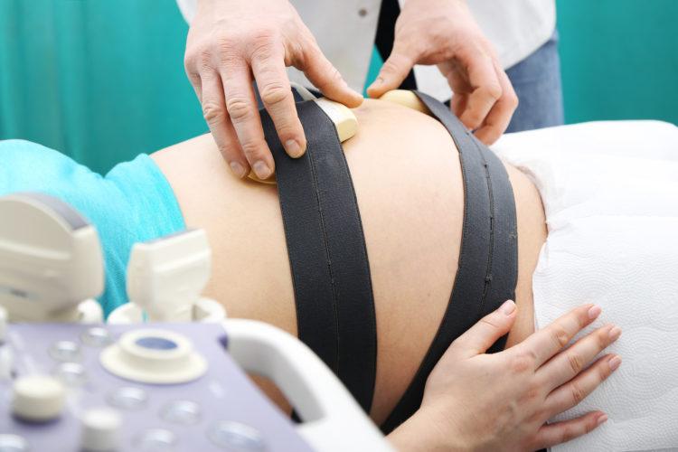 Đo tim thai trong quá trình chuyển dạ