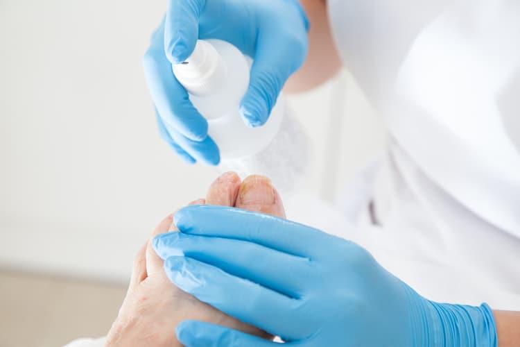 Điểm danh 9 loại thuốc trị hắc lào được bác sĩ tin dùng