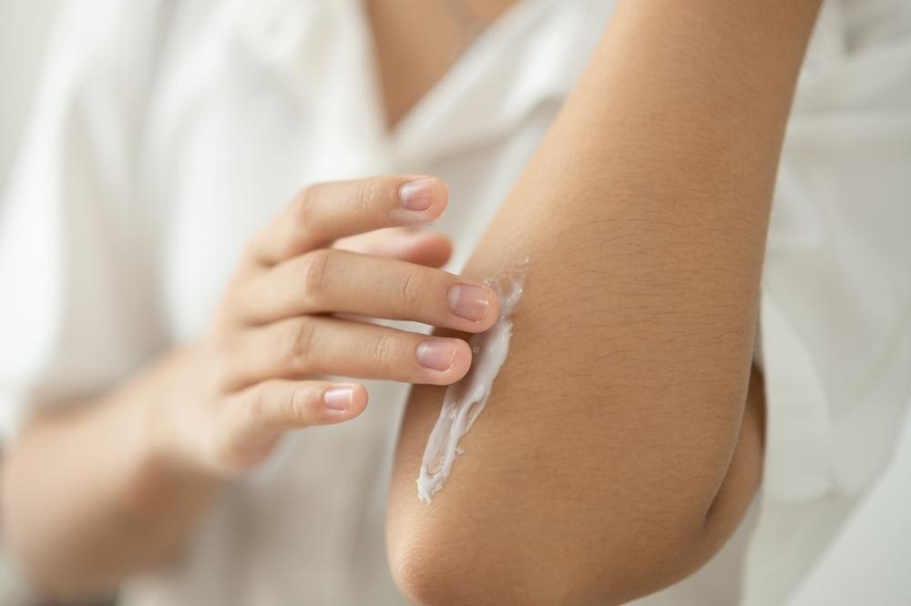 Nên chọn đúng loại thuốc trị sẹo để đảm bảo hiệu quả điều trị.