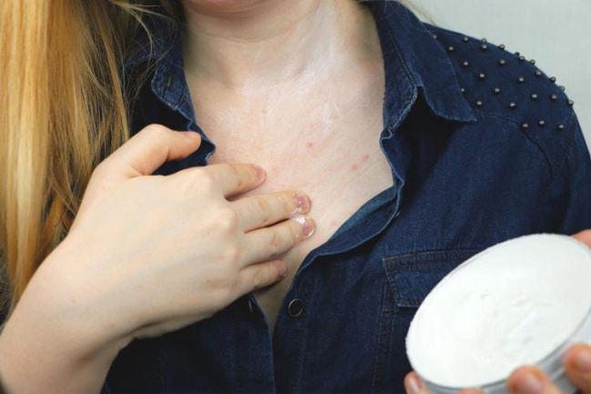 Bật mí các cách điều trị bệnh ghẻ hiệu quả