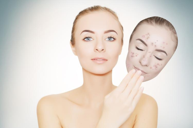 Những loại thuốc trị thâm mụn hiệu quả