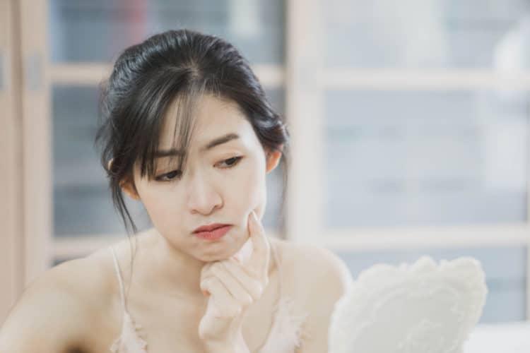 Cách trị nám tàn nhang: Làm sao để nhanh hết nám?